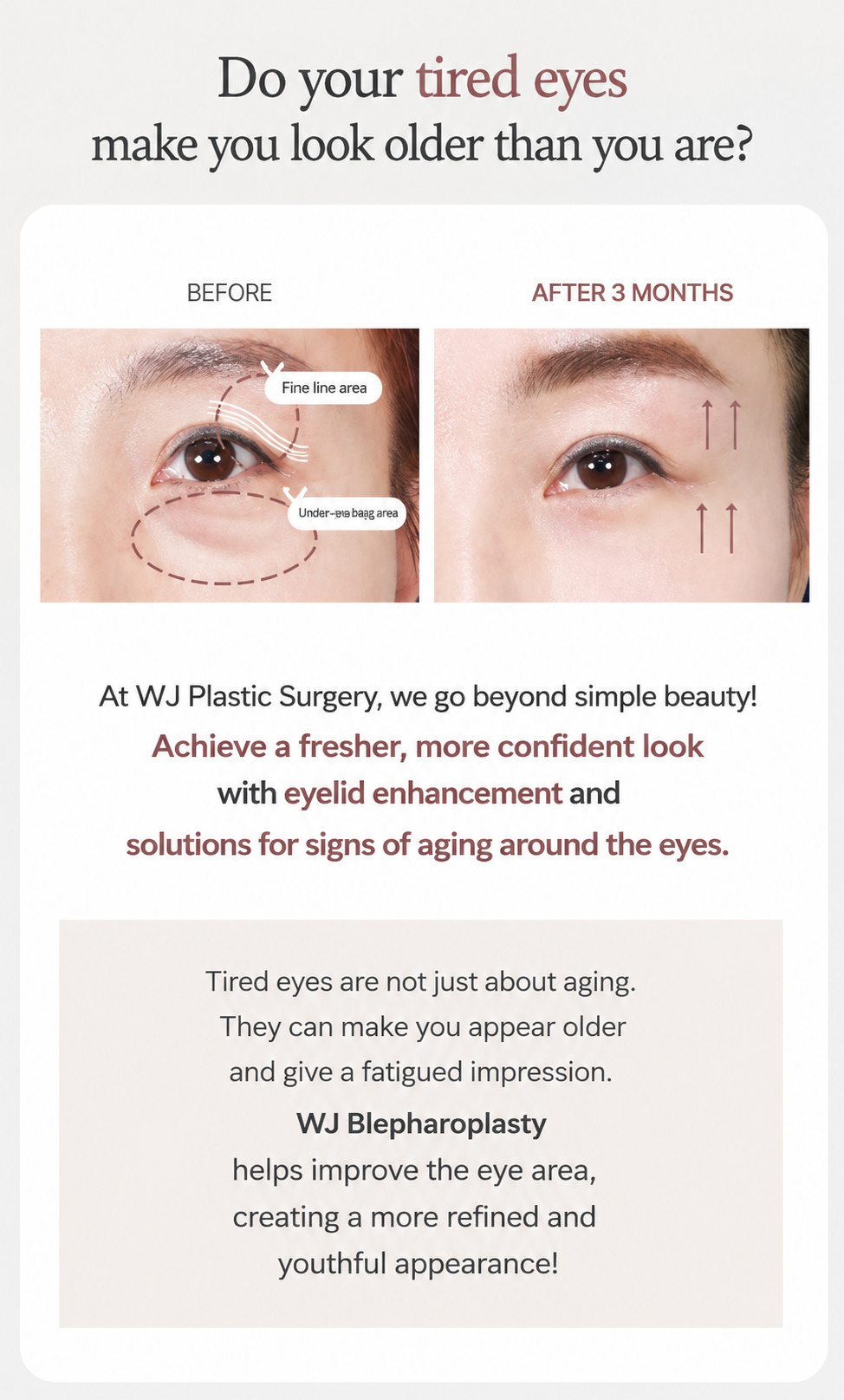 Mature woman considering eye rejuvenation